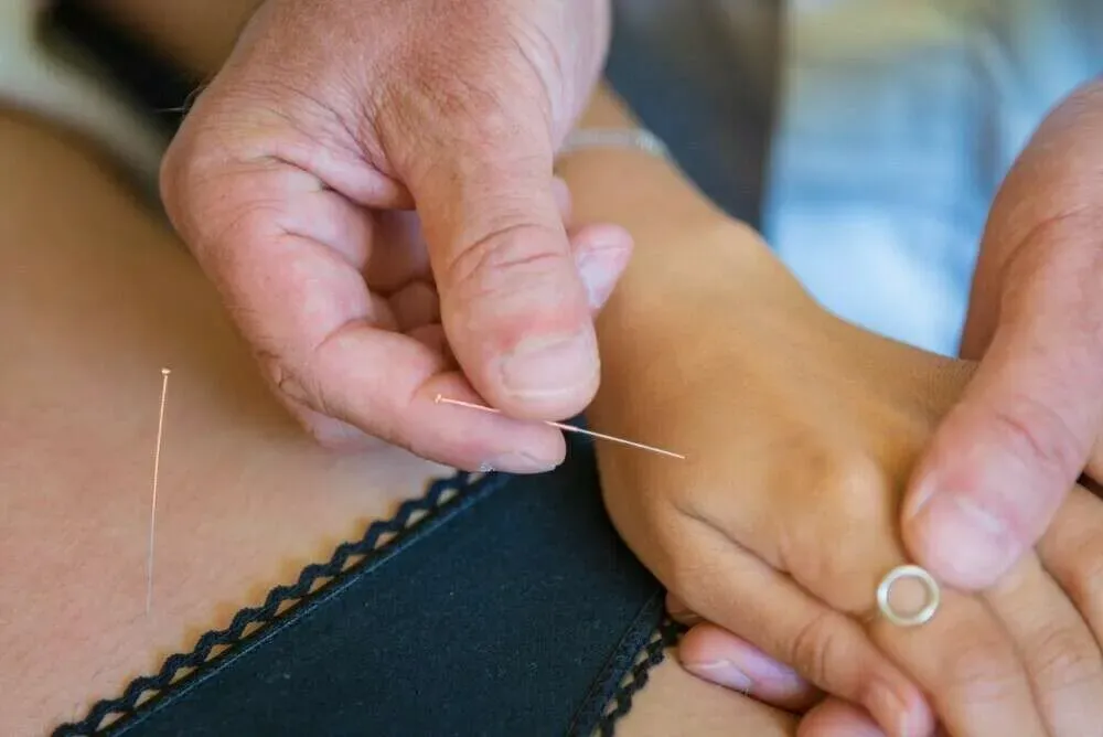 Meilleur acupuncteur à Marseille
